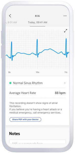 Withings - BPM Core,withings,bpm,coreaparelho,medidor,de,tensao,arterial,faz,tambem,electrocardiograma,É,compativel,com,ios,e,android,quando,colocado,perto,do,peito,tem,um,estetoscopio,digital,que,mede,as,frequências,d